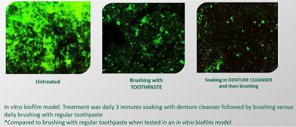 Images showing how more bacteria and yeast is removed by soaking appliance in Polident compared to brushing with toothpaste
