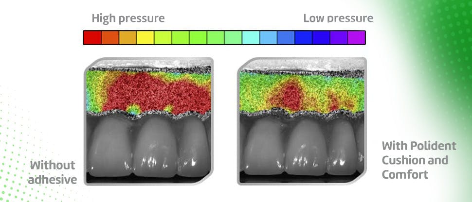 Pressure relieved on gums by using Polident adhesive