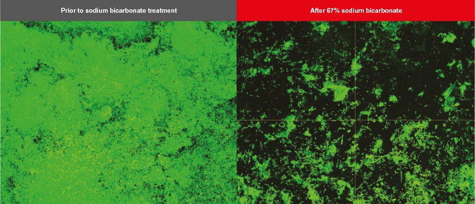 Biofilm confocal laser scanning microscopy (CLSM) images