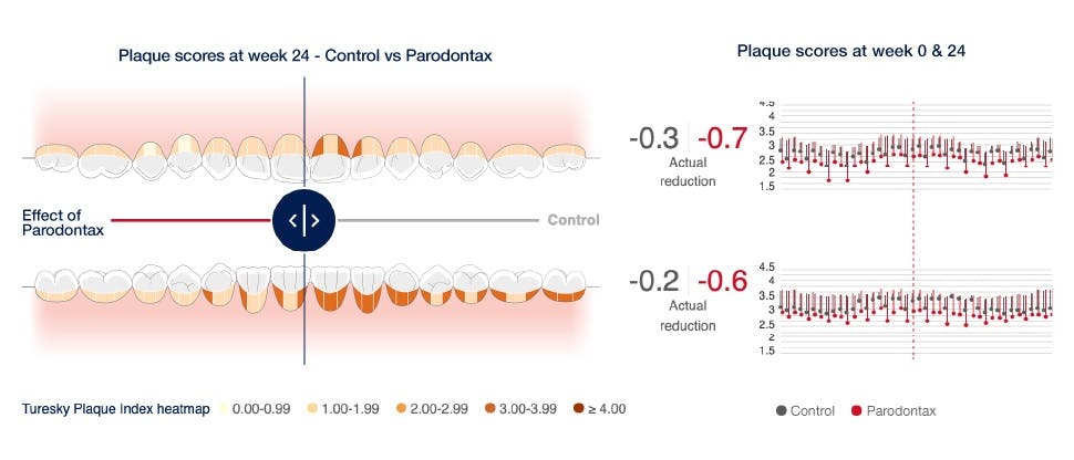 Image of the mouth map tool showing the reduction of plaque after using paradontax sodium bicarbonate toothpaste