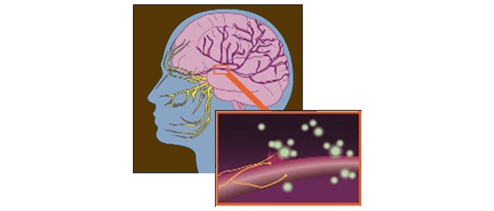 Firing neurons at the trigeminal area