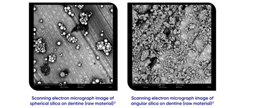 Scanning electron micrograph image of spherical and angular cleaning particles