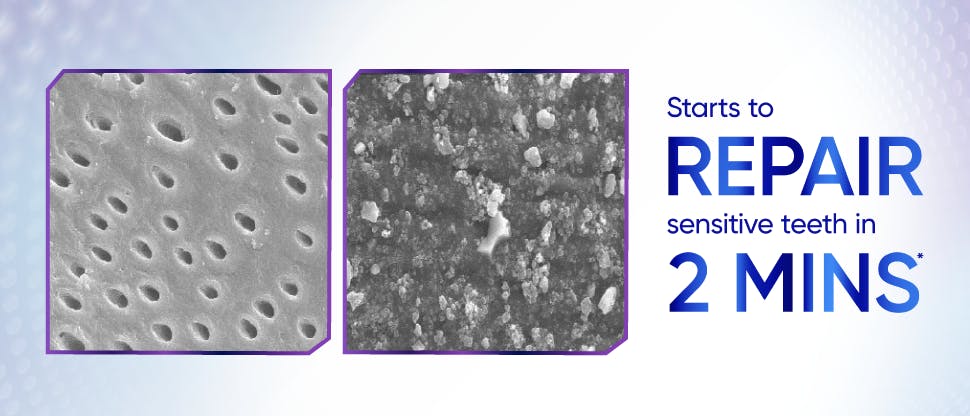 Image under a microscope of dentine tubules 