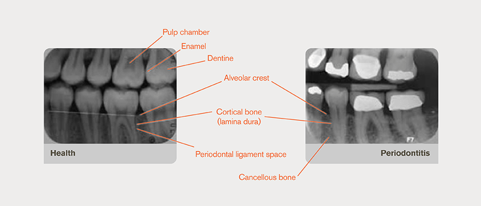 Annotated radiograph