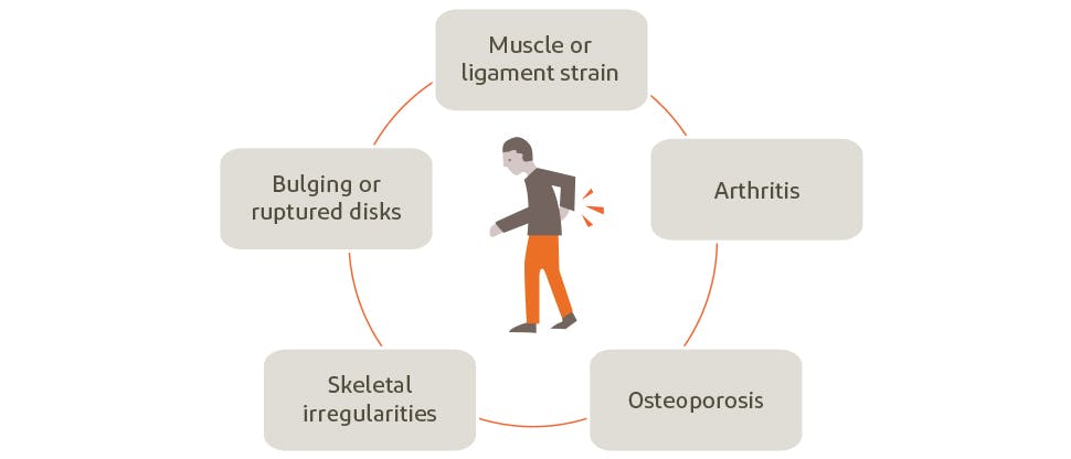 Graphic depicting potential causes of back pain