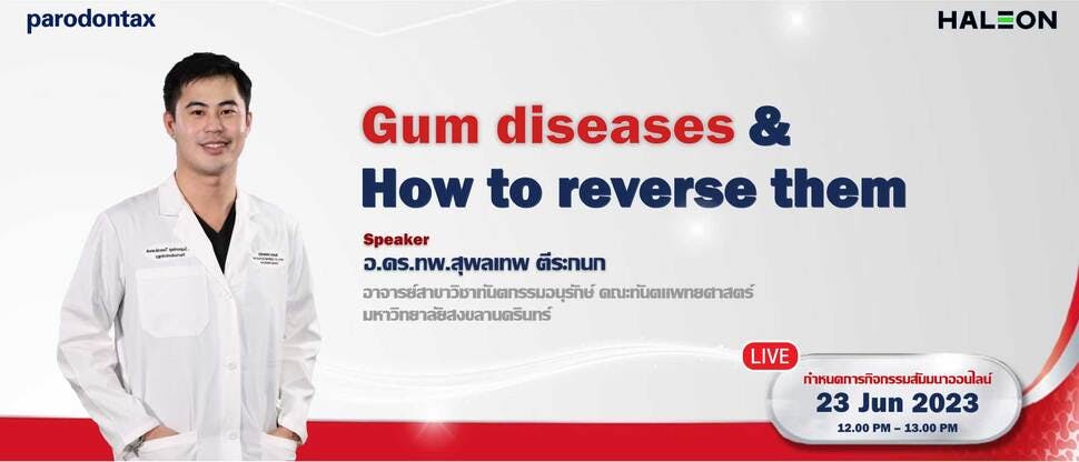 Gum diseases & how to reverse them 