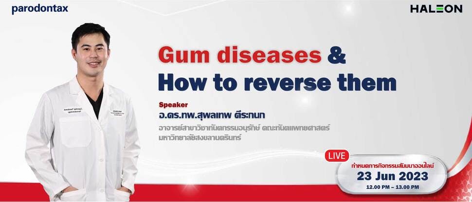 Gum diseases & how to reverse them