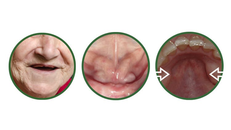 Print Oral anatomy