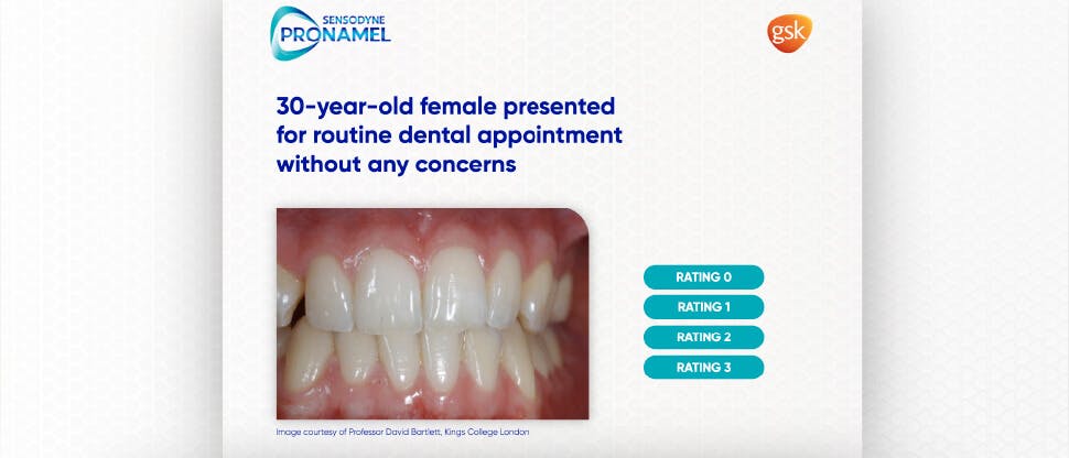 enamel erosion quiz