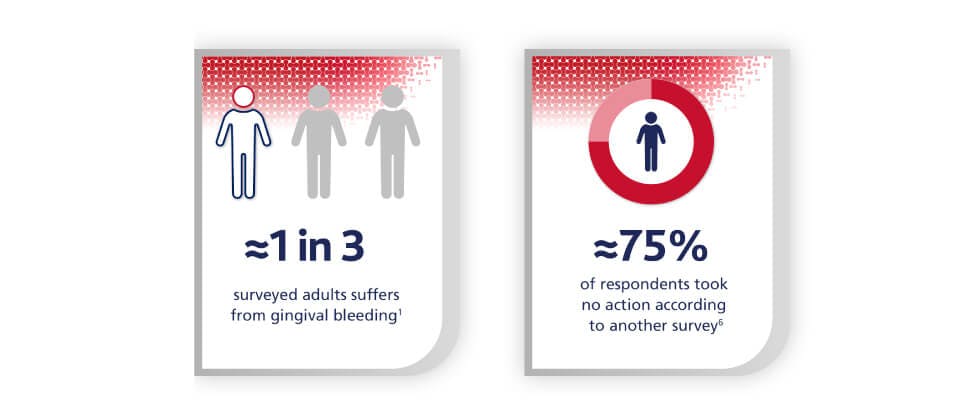 1 in 3 adults suffer from bleeding gums; 75% took no action with bleeding gums