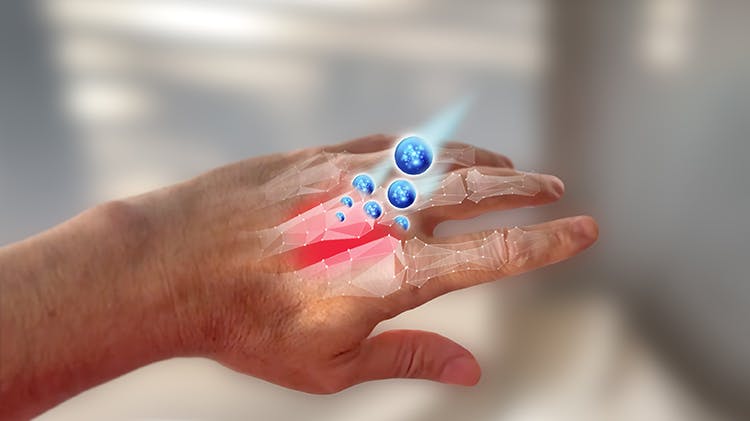 Voltaren hand efficacy graphic