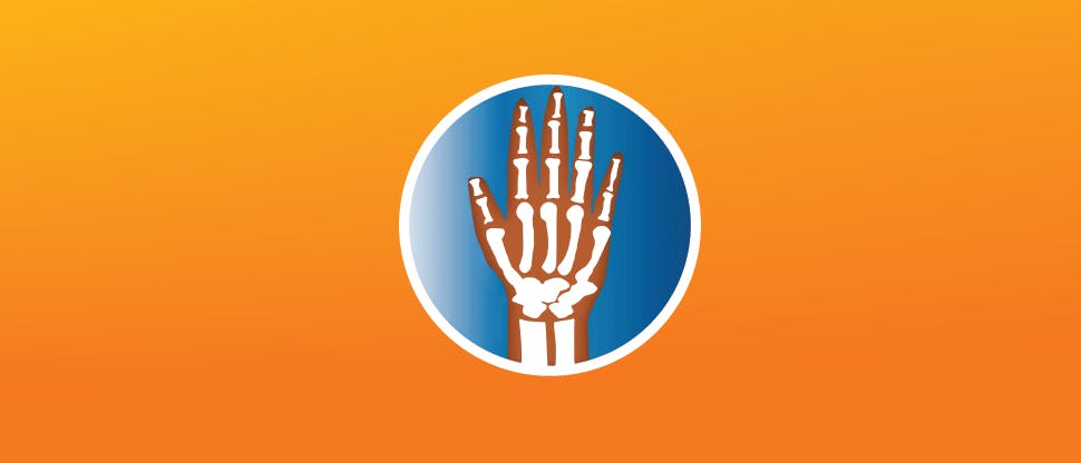 OA Hand Pain Relief