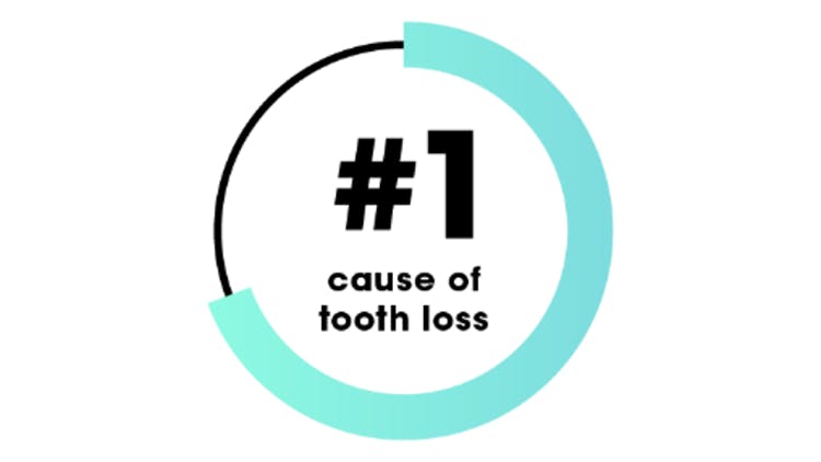 Periodontal disease is the most common cause of tooth loss