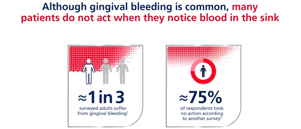 Gingivitis statistics on treatment