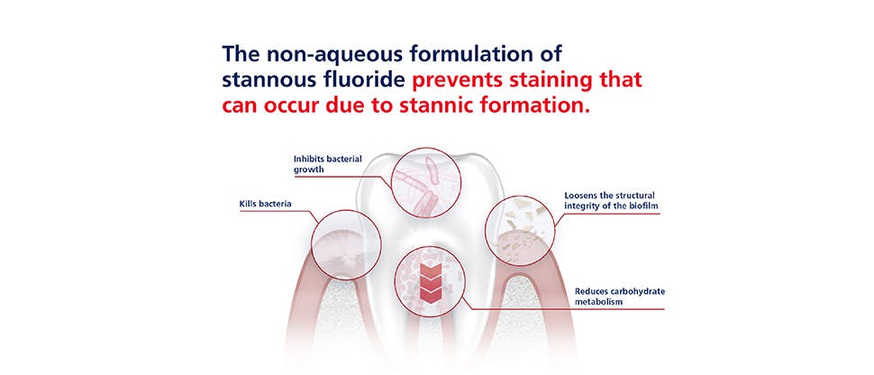Benefits of non-aqueous formulation of stannous fluoride 