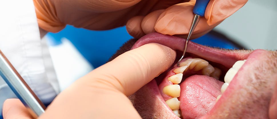 Dental patient with gum disease at practice reception
