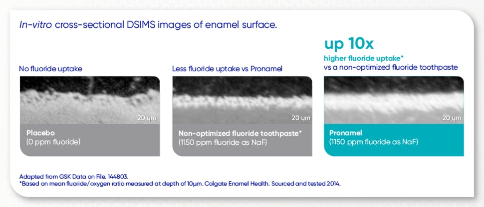 Fluoride uptake images