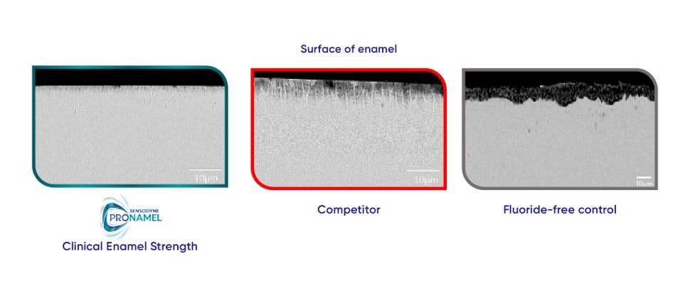 Significantly Increased Erosive Resistance to Further Acid Challenges