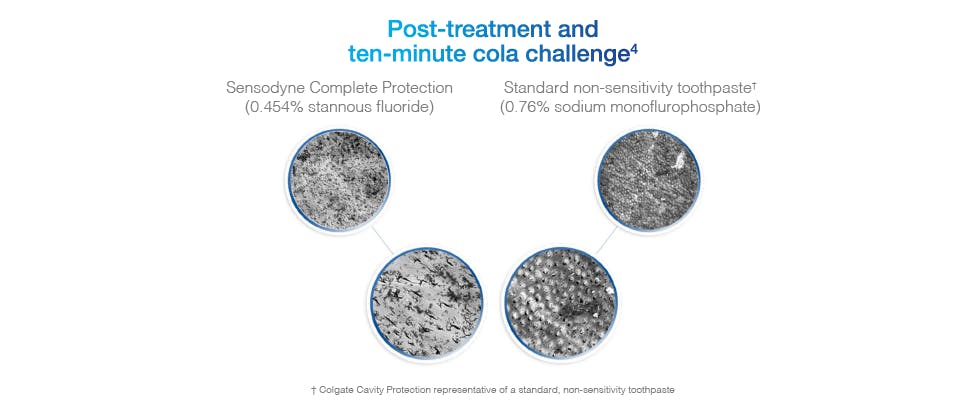 Close up of tooth treated with Sensodyne Complete Protection toothpaste vs standard non-sensitivity toothpaste