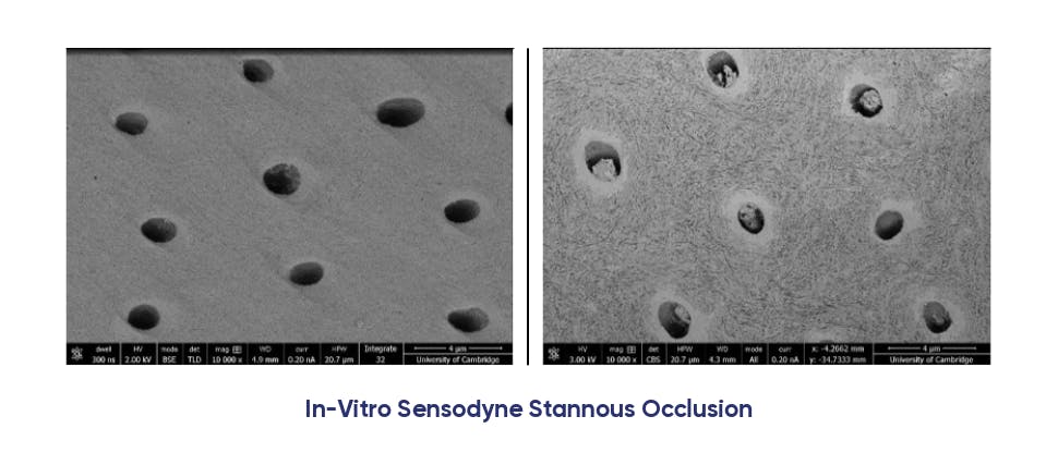 In-vitro Sensodyne Stannous Occlusion