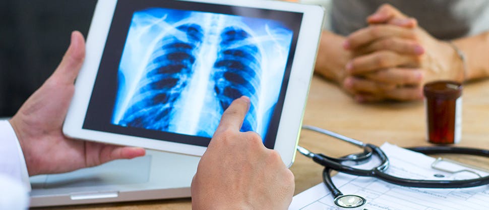 Doctor talking to a patient about a chest x-ray.