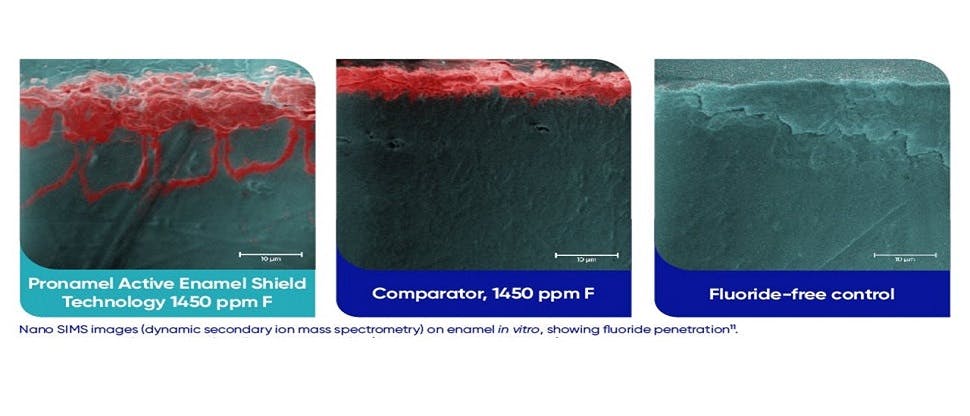 Images showing fluoride penetration of tooth enamel by Pronamel Active Enamel Shield toothpaste, compared with lesser penetration by a comparator toothpaste containing the same amount of fluoride