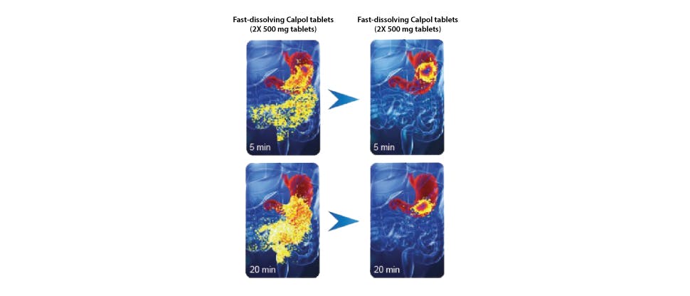 Images showing the rapidity of Calpol Tablets disintegration in the stomach compared to standard paracetamol tablets