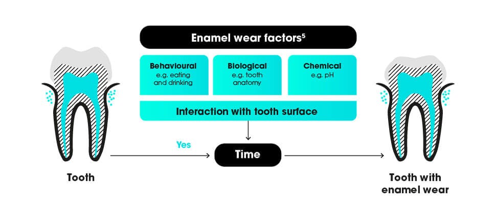 Erosive tooth wear factors infographic
