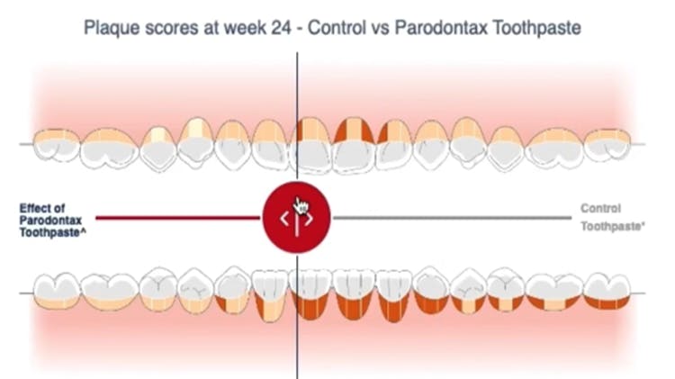 parodontax Interactive Mouth Map Tool