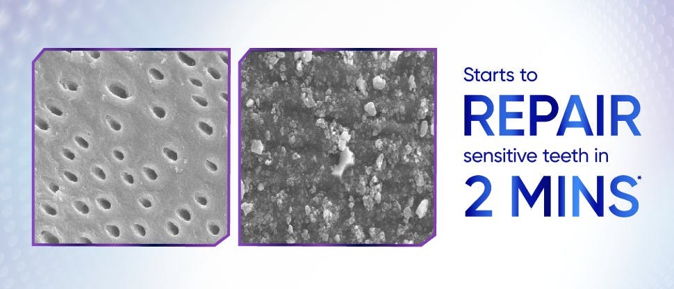 Image under a microscope of dentine tubules 