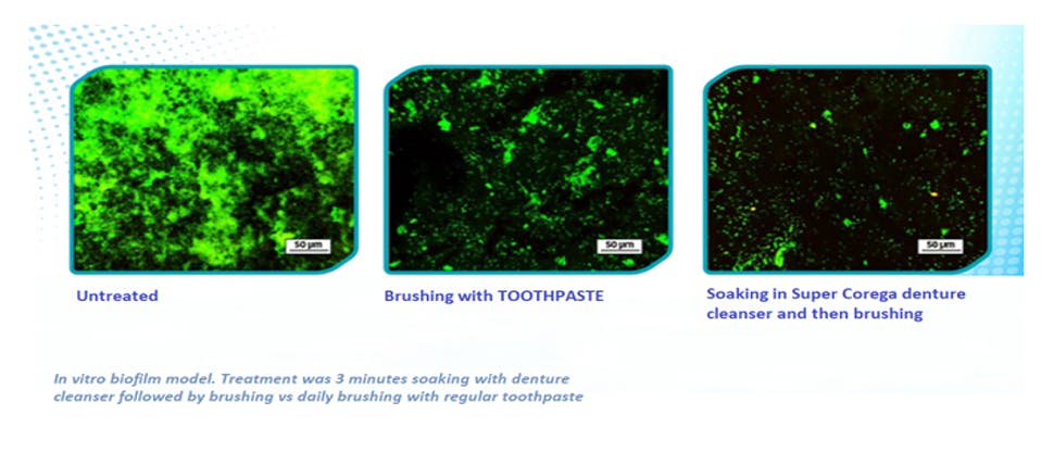 Images showing how more bacteria and yeast is removed by soaking appliance in Super Corega compared to brushing with toothpaste