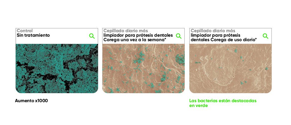 Demostración de cómo se eliminan más bacterias al remojar la prótesis en Corega en comparación con cepillarla con crema dental