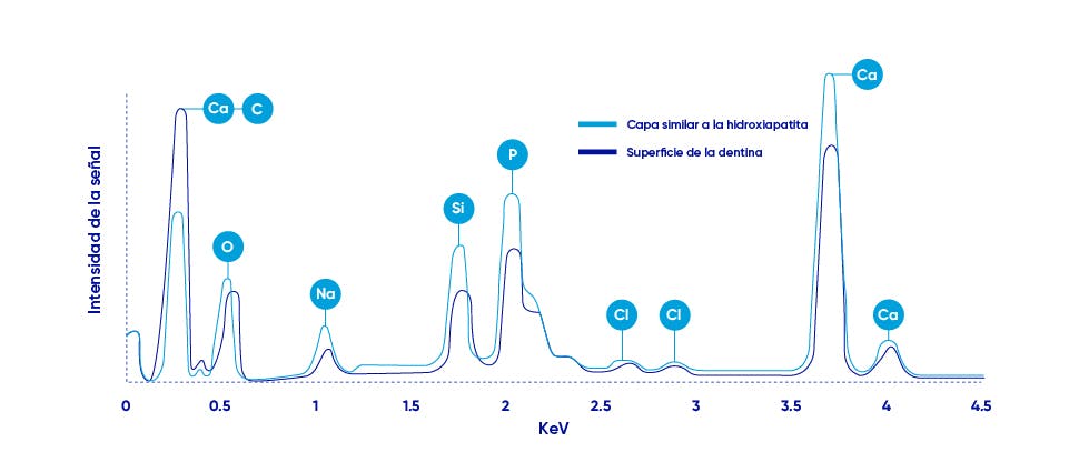 Gráficos de rayos X del gráfico de la dentina