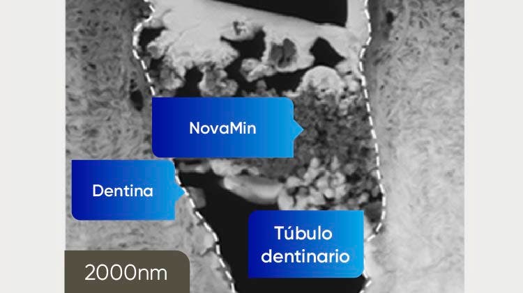 Imagen TEM de la dentina a 2000nm