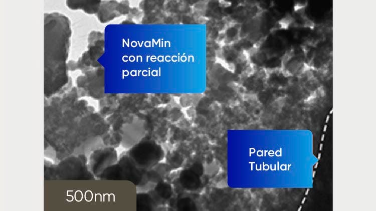 Imagen TEM de la dentina a 500nm