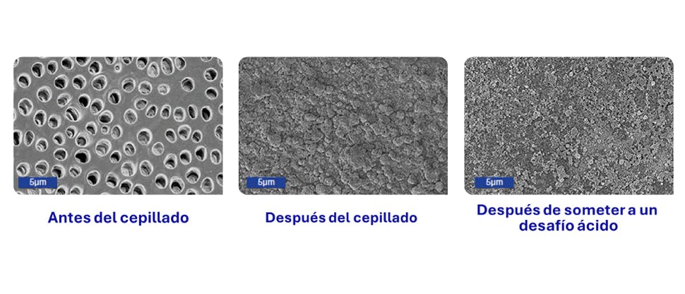 Imágenes de microscopio electrónico de barrido (SEM) de la superficie de la dentina