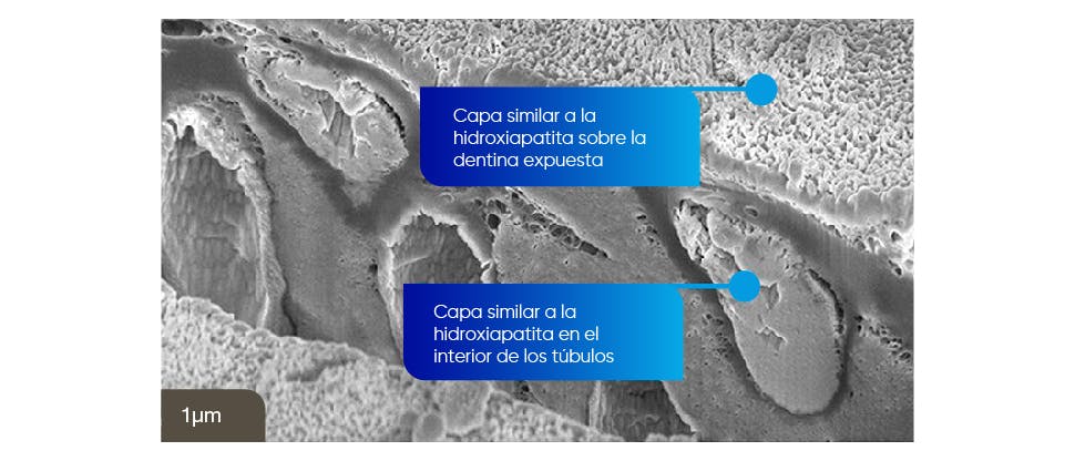 Imagen SEM de una capa similar a la hidroxiapatita sobre la dentina expuesta