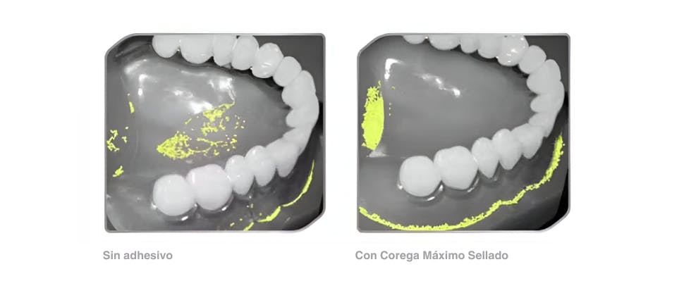 Imágenes de atrapamiento de alimentos con y sin adhesivo Corega