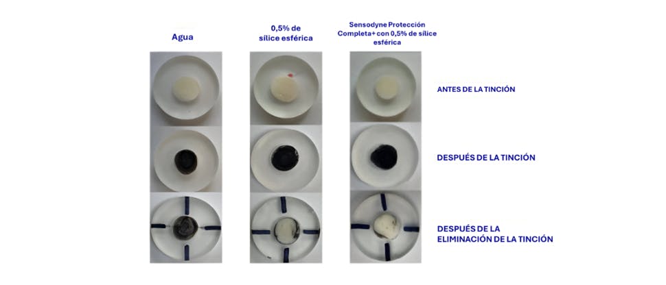 Imagen de la mancha dental después del cepillado