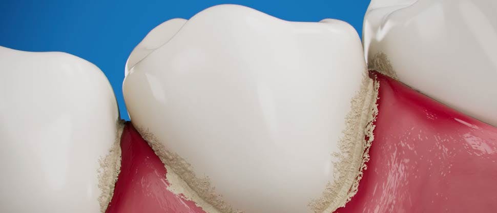 Crema dental para la sensibilidad