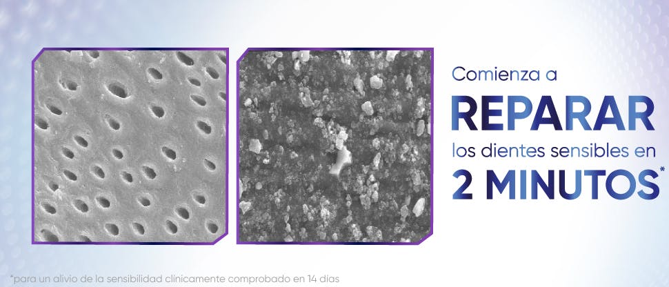 Imagen de túbulos dentinarios bajo un microscopio