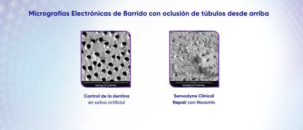 Imagen de túbulos dentinarios después del tratamiento con crema dental