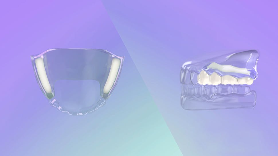 Modo de acción del adhesivo para prótesis dentales
