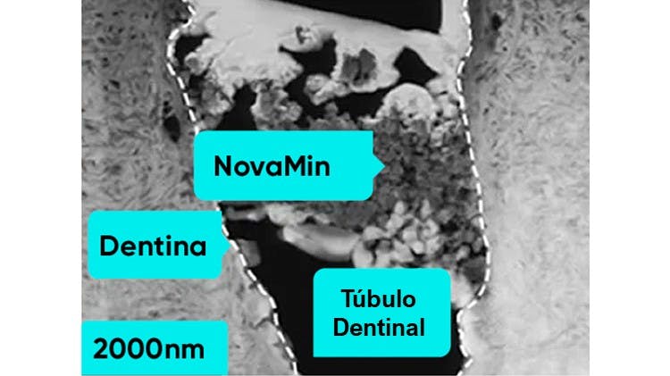 Imagen TEM de la dentina a 2000nm