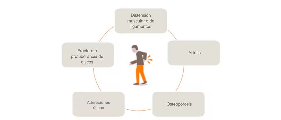 Gráfico que muestra las posibles causas del dolor de espalda