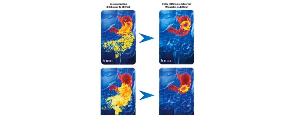Imágenes que muestran la rapidez de desintegración de Dolex Avanzado en el estómago en comparación con los comprimidos de acetaminofén estándar 