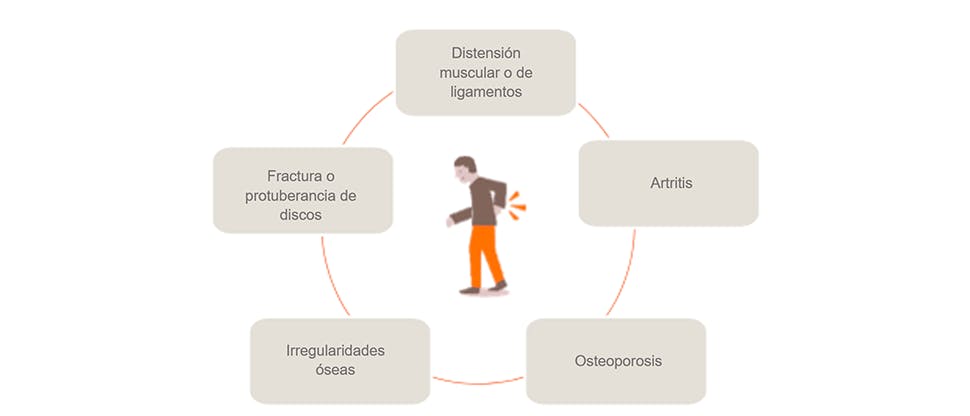 Gráfico que muestra las posibles causas del dolor de espalda