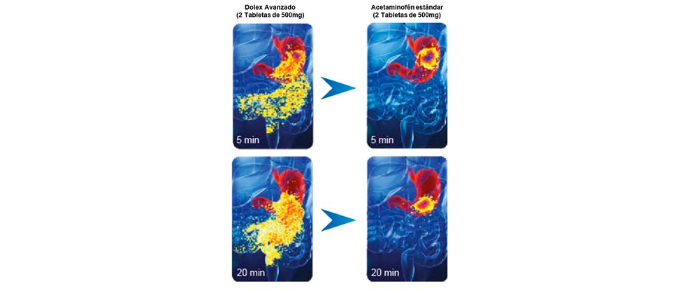 Imágenes que muestran la rapidez de desintegración de Dolex Avanzado en el estómago en comparación con los comprimidos de acetaminofén estándar 