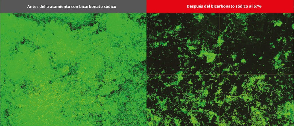 Imágenes de la biopelícula del microscopio confocal láser (CLSM)