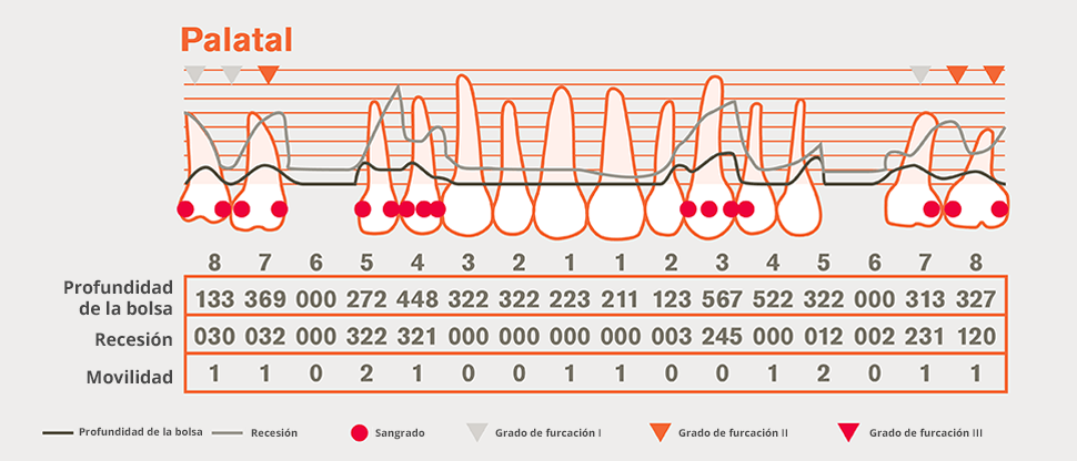 Gráfico periodontal detallado 